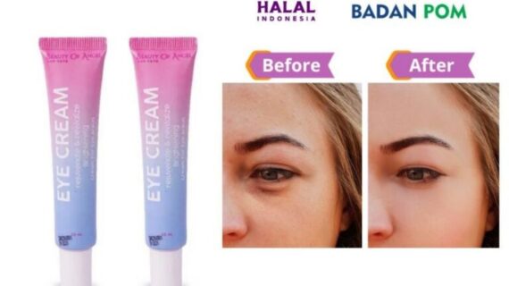 Eye Cream – MLY – YT